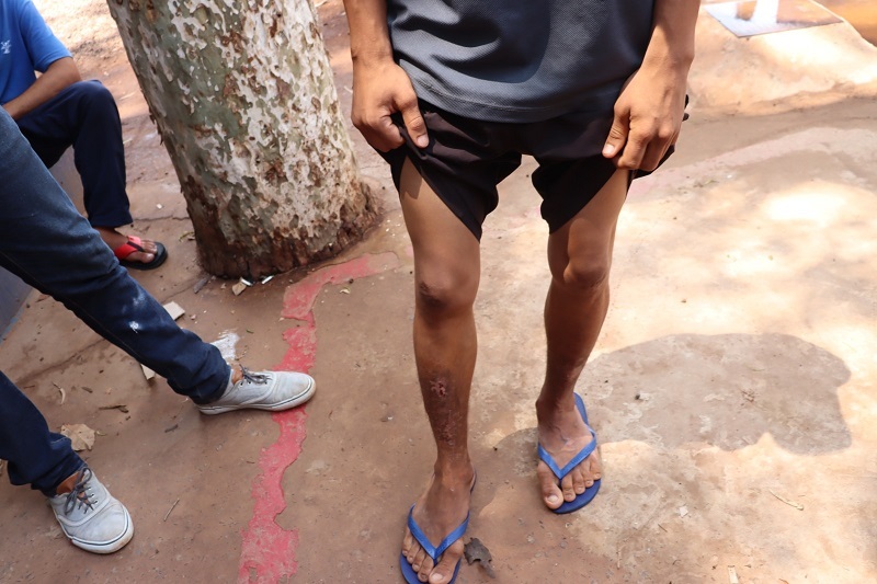 Clinica carcere homens multilados